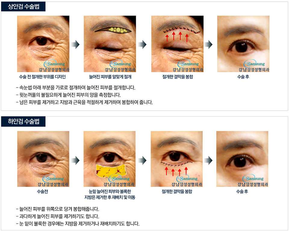 ::서울대학교 동문병원 강남삼성성형외과입니다